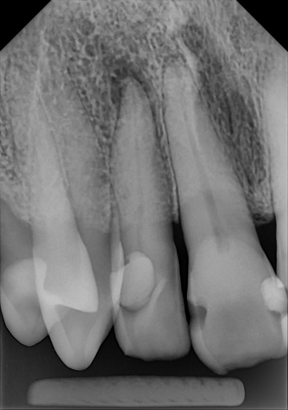 DC-Air anterior X-ray 1