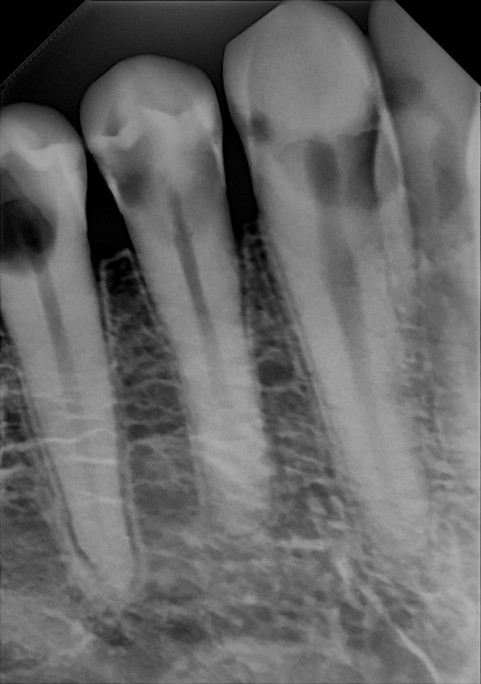 DC-Air anterior X-ray 3