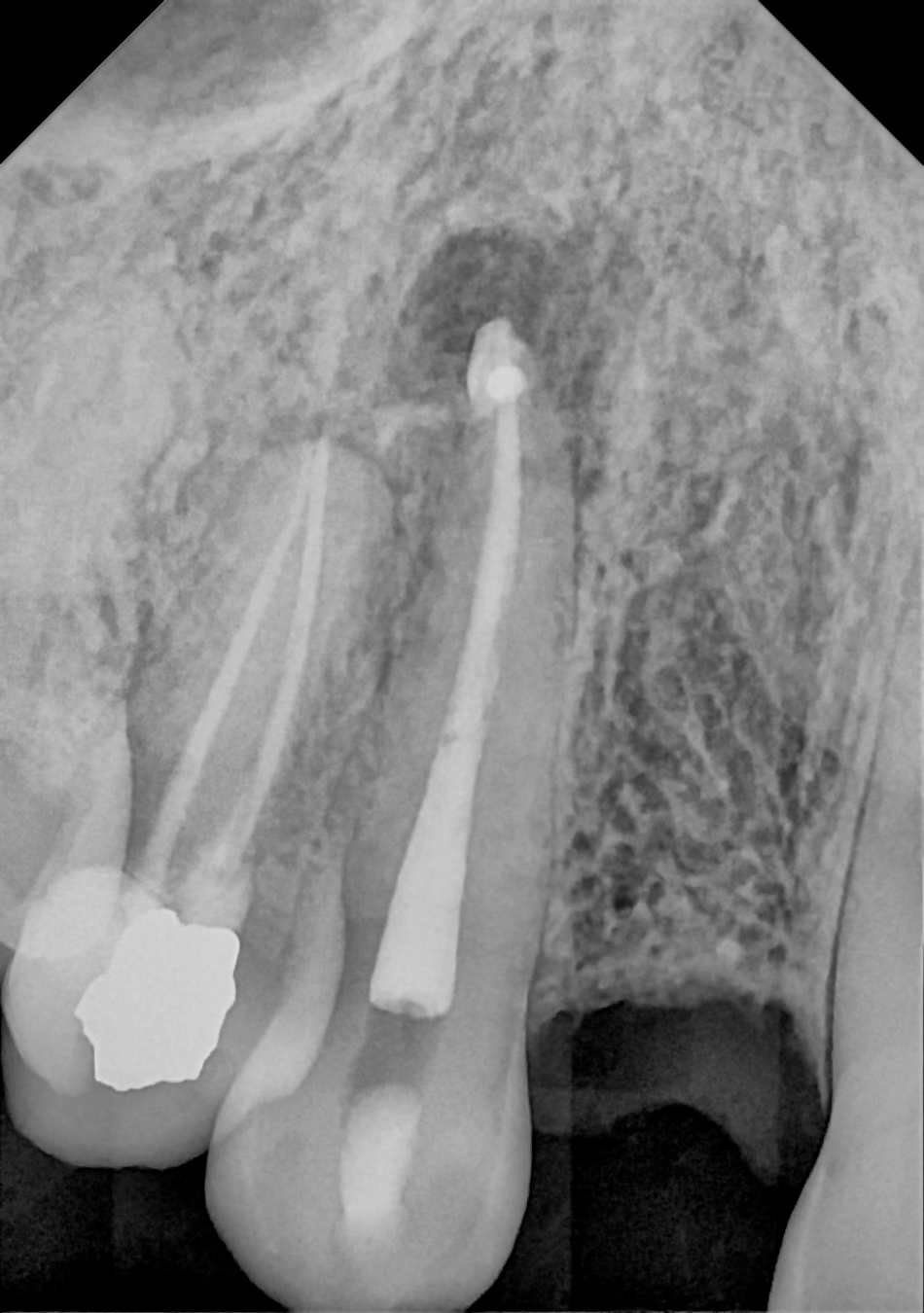 DC-Air anterior X-ray 5