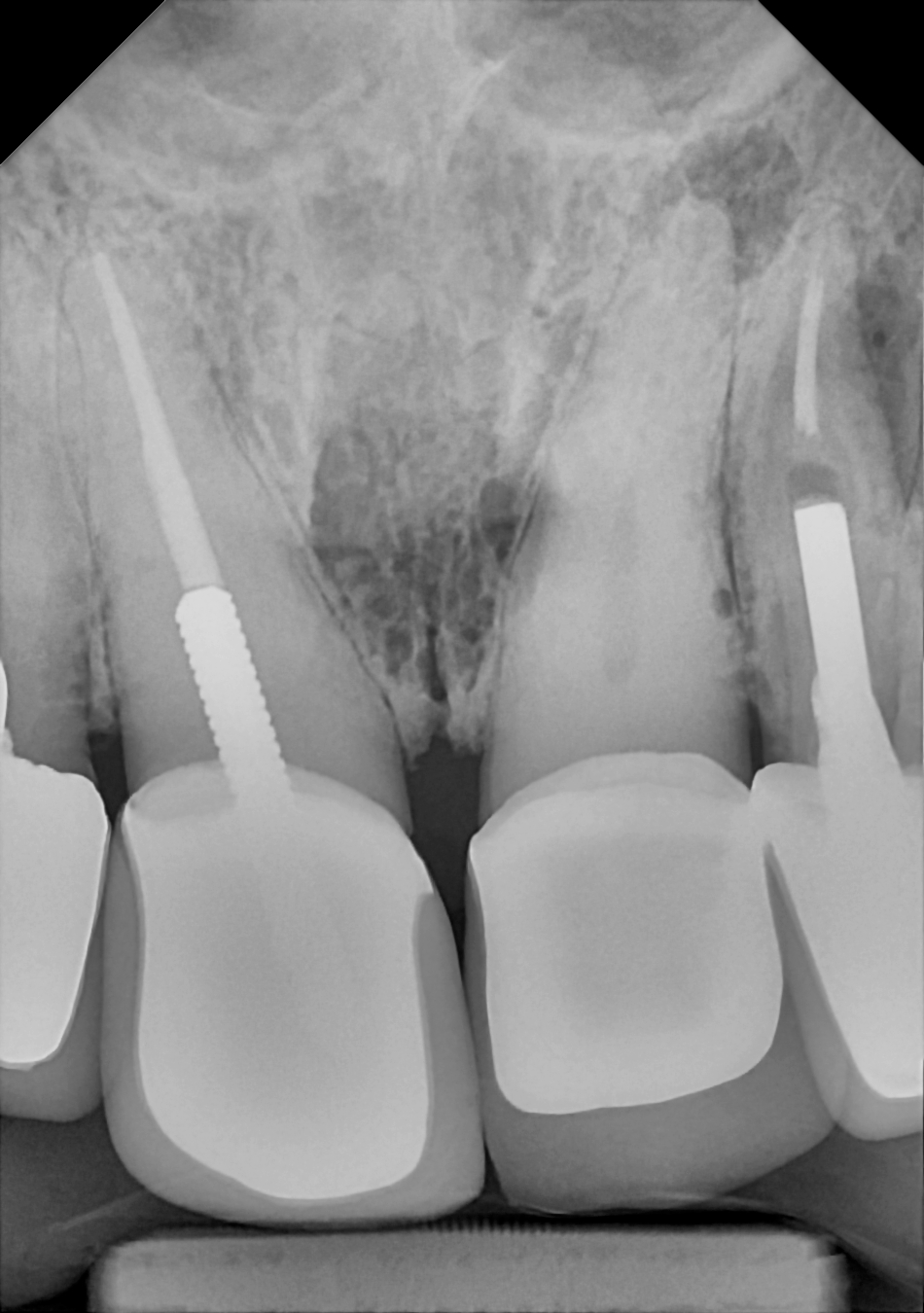 DC-Air anterior X-ray 6