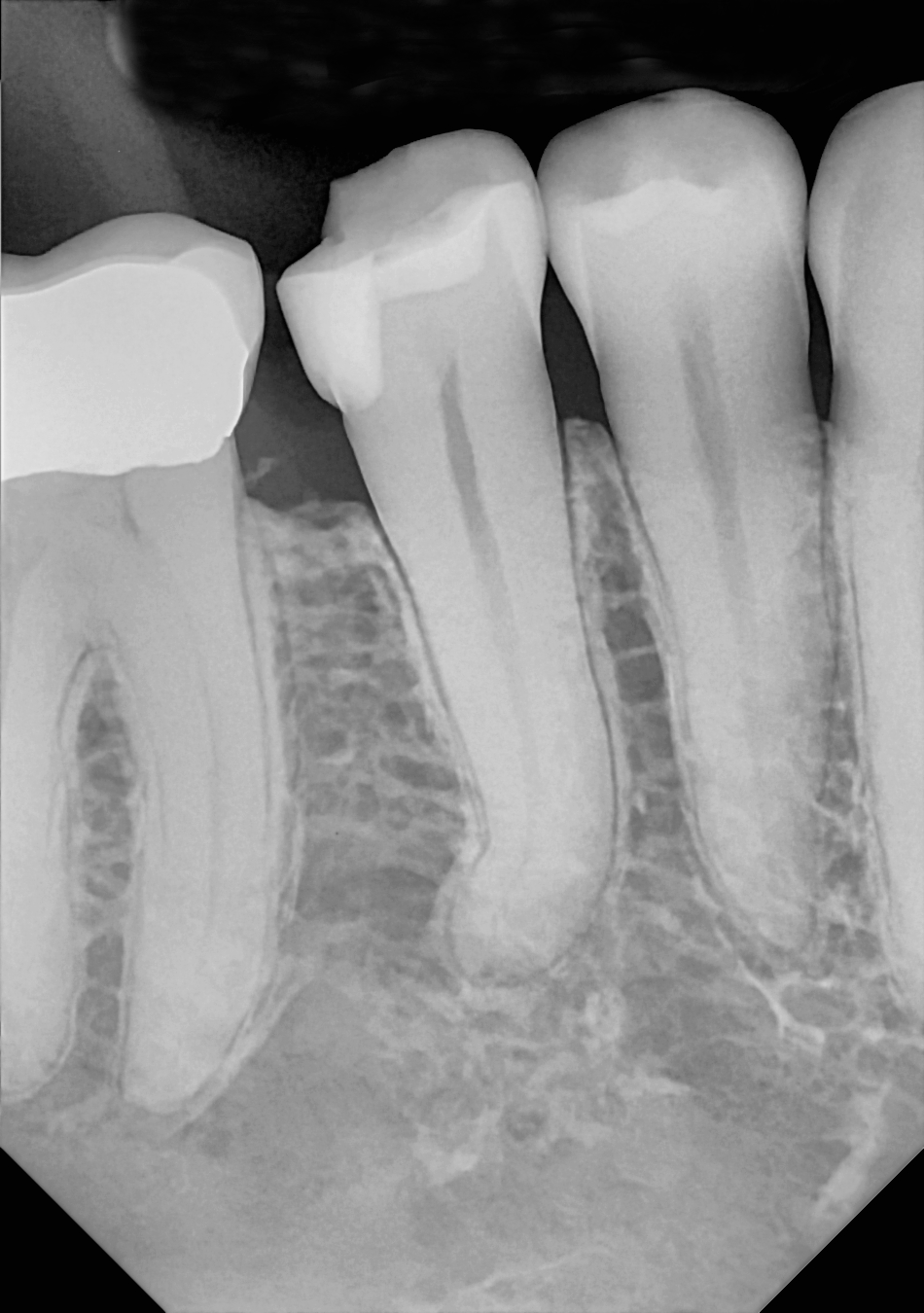 DC-Air posterior X-ray 5