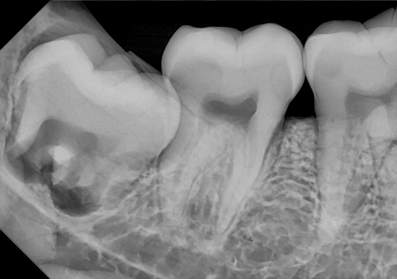 DC-Air posterior X-ray 6
