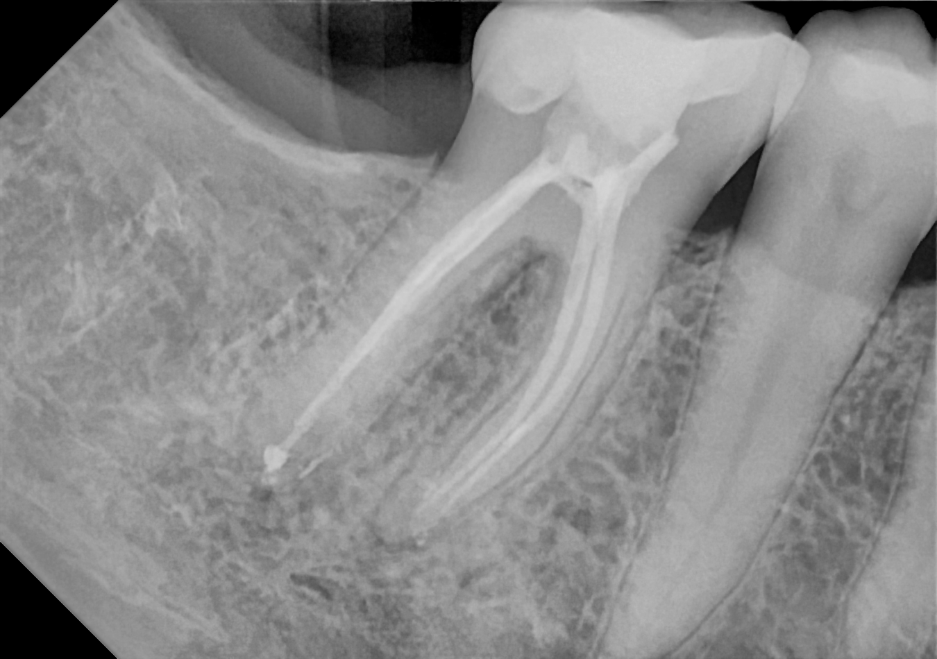DC-Air posterior X-ray 7